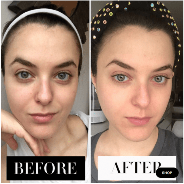 Before and after stories